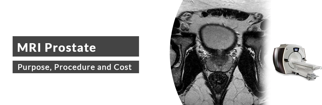  MRI Prostate: Purpose, Procedure, Cost and Best MRI Centre